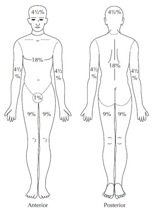 Figure 3.2 Rule of nines.